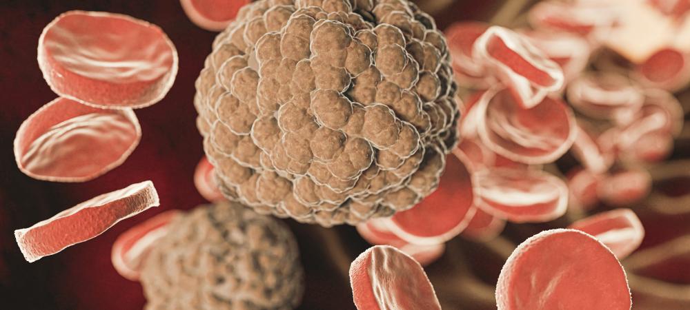 How Does Blood Cancer Develop?
