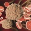 How Does Blood Cancer Develop?
