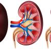 Signs Your Kidneys Might Be in Trouble