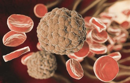 How Does Blood Cancer Develop?