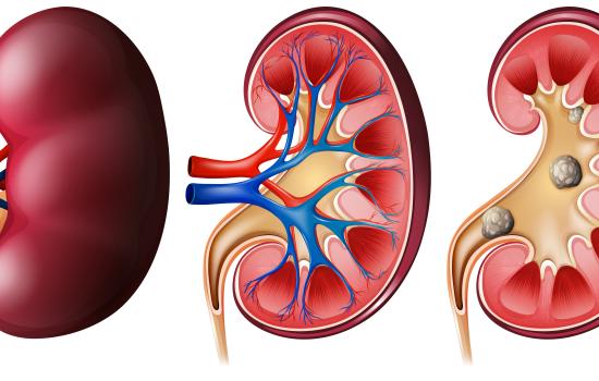 Signs Your Kidneys Might Be in Trouble