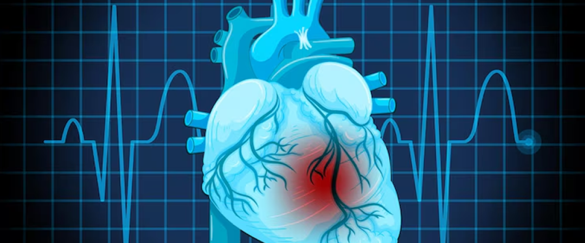 Tetralogy of Fallot (TOF)