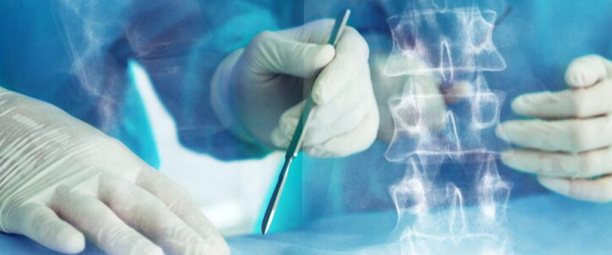 Spinal Cord Tumor Excision Surgery