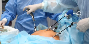 Endoscopic Discectomy Surgery